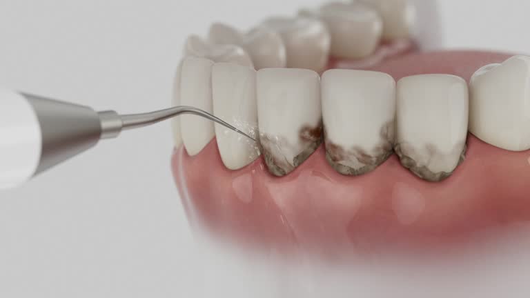 Trusted Teeth Cleaning And Checkup service in Arnold Line, MS - Dentist Open Now